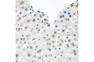 Immunohistochemistry of paraffin-embedded mouse liver using TARDBP antibody. (TARDBP Antikörper  (AA 1-100))
