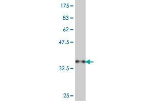 Western Blot detection against Immunogen (38. (PAX2A Antikörper  (AA 194-303))