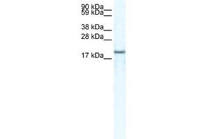 WB Suggested Anti-CXCL14 Antibody Titration:  5. (CXCL14 Antikörper  (Middle Region))