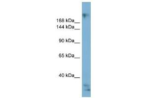 EXPH5 antibody used at 1 ug/ml to detect target protein. (Exophilin 5 Antikörper  (Middle Region))