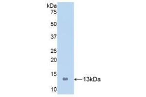 Detection of Recombinant S100A8, Human using Polyclonal Antibody to S100 Calcium Binding Protein A8 (S100A8) (S100A8 Antikörper  (AA 1-93))