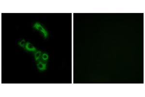 Immunofluorescence analysis of A549 cells, using C1QB antibody. (C1QB Antikörper  (C-Term))