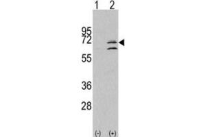 Western Blotting (WB) image for anti-Mitogen-Activated Protein Kinase 15 (MAPK15) antibody (ABIN3003285)