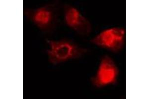 ABIN6268665 staining HeLa cells by IF/ICC. (SMAD5 Antikörper  (Internal Region))