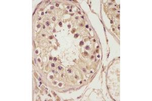 (ABIN6243400 and ABIN6578788) staining NSFL1C in human testis tissue sections by Immunohistochemistry (IHC-P - paraformaldehyde-fixed, paraffin-embedded sections). (NSFL1C Antikörper  (AA 214-248))