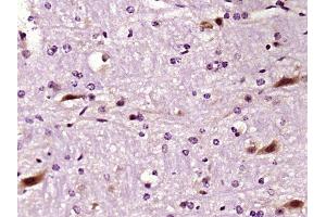 Paraformaldehyde-fixed, paraffin embedded mouse brain, Antigen retrieval by boiling in sodium citrate buffer (pH6) for 15min, Block endogenous peroxidase by 3% hydrogen peroxide for 30 minutes,  Blocking buffer (normal goat serum) at 37°C for 20min, Antibody incubation with LIMK1 Polyclonal Antibody (bs-2775R) at 1:400 overnight at 4°C, followed by a conjugated secondary and DAB staining. (LIM Domain Kinase 1 Antikörper  (AA 451-550))