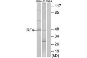 Western blot analysis of extracts from HeLa/Jurkat cells, using IRF4 Antibody. (IRF4 Antikörper  (AA 281-330))