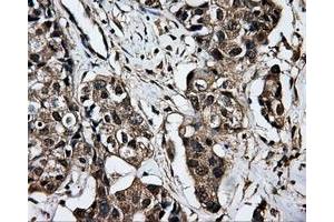 Immunohistochemistry (IHC) image for anti-Dicarbonyl/L-Xylulose Reductase (DCXR) antibody (ABIN1497785) (DCXR Antikörper)