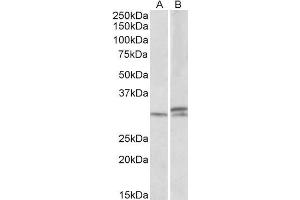 ABIN570860 (1µg/ml) staining of Mouse and Rat Spinal Cord lysates (35µg protein in RIPA buffer). (HOXA9 Antikörper  (AA 37-50))