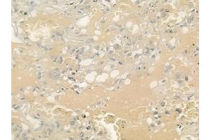 ABIN6262978 and ABIN6276676 at 1/100 staining human normal lung tissue by IHC-P. (LIPC Antikörper  (Internal Region))