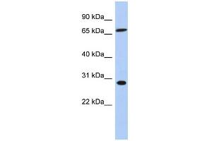 WB Suggested Anti-SFRS7 Antibody Titration: 0. (SFRS7 Antikörper  (Middle Region))