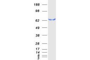 Western Blotting (WB) image for SH3-Domain Binding Protein 2 (SH3BP2) (Transcript Variant 1) protein (Myc-DYKDDDDK Tag) (ABIN2731972)