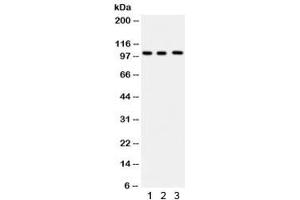 Western blot testing of 1) human HeLa, 2) Raji and 3) U937 lysate with ITCH antibody. (ITCH Antikörper)
