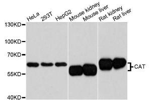 Western blot analysis of extracts of various cell lines, using CAT antibody. (Catalase Antikörper  (AA 1-225))