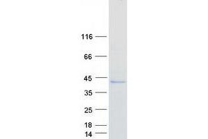 Validation with Western Blot (FcRn Protein (Transcript Variant 1) (Myc-DYKDDDDK Tag))