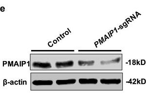 PMAIP1 is a CK-resistant gene. (NOXA Antikörper  (AA 1-54))