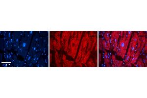 Rabbit Anti-LASP1 Antibody Catalog Number: ARP54798_P050 Formalin Fixed Paraffin Embedded Tissue: Human heart Tissue Observed Staining: Cytoplasmic Primary Antibody Concentration: N/A Other Working Concentrations: 1:600 Secondary Antibody: Donkey anti-Rabbit-Cy3 Secondary Antibody Concentration: 1:200 Magnification: 20X Exposure Time: 0. (LASP1 Antikörper  (C-Term))