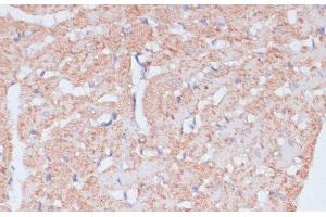 Immunohistochemistry of paraffin-embedded Rat heart using MZB1 Polyclonal Antibody at dilution of 1:100 (40x lens). (MZB1 Antikörper)
