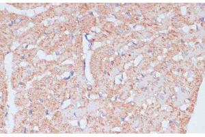 Immunohistochemistry of paraffin-embedded Rat heart using MZB1 Polyclonal Antibody at dilution of 1:100 (40x lens).