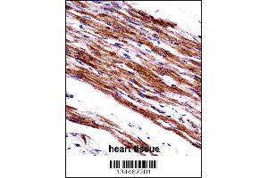 MYL9 Antibody immunohistochemistry analysis in formalin fixed and paraffin embedded human heart tissue followed by peroxidase conjugation of the secondary antibody and DAB staining. (MYL9 Antikörper  (C-Term))