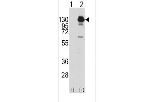 Western blot analysis of PDGFRA (arrow) using rabbit polyclonal PDGFRA Antibody  (R). (PDGFRA Antikörper  (AA 740-769))