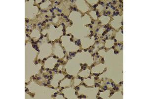 Immunohistochemistry of paraffin-embedded Mouse lung using RNGTT antibody at dilution of 1:100 (x400 lens). (RNGTT Antikörper)