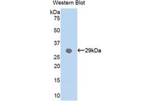 Western blot analysis of the recombinant protein. (MYD88 Antikörper  (AA 32-265))