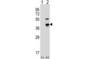 Western Blotting (WB) image for anti-Cyclin-Dependent Kinase 3 (CDK3) antibody (ABIN2997548) (CDK3 Antikörper)