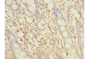 Immunohistochemistry of paraffin-embedded human colon tissue using ABIN7162305 at dilution of 1:100