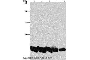 Western blot analysis of A549 and hela cell, mouse liver and human liver tissue, hepG2 cell, using PGK1 Polyclonal Antibody at dilution of 1:850 (PGK1 Antikörper)