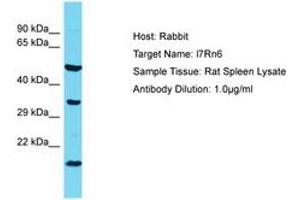 Image no. 1 for anti-Chromosome 11 Open Reading Frame 73 (C11orf73) (AA 37-86) antibody (ABIN6750374) (C11orf73 Antikörper  (AA 37-86))