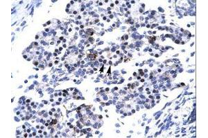 Image no. 3 for anti-Caudal Type Homeobox 4 (CDX4) (C-Term) antibody (ABIN6736267) (CDX4 Antikörper  (C-Term))
