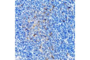 Immunohistochemistry of paraffin-embedded mouse spleen using PSMD10 antibody  at dilution of 1:100 (40x lens). (PSMD10 Antikörper  (AA 1-226))