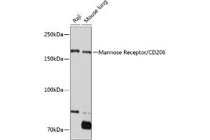 Western blot analysis of extracts of various cell lines, using Mannose Receptor/CD206 Rabbit mAb (ABIN7268388) at 1:1000 dilution. (Macrophage Mannose Receptor 1 Antikörper)