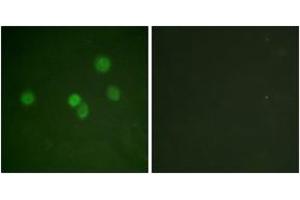 Immunofluorescence analysis of A549 cells, using SP1 (Ab-453) Antibody. (SP1 Antikörper  (AA 421-470))