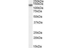 Western Blotting (WB) image for anti-Double Homeobox 1 (DUX1) (N-Term) antibody (ABIN2776490)