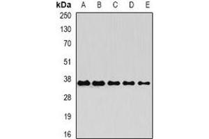 Western blot analysis of OSGEP expression in Raji (A), Jurkat (B), mouse heart (C), mouse ovary (D), rat liver (E) whole cell lysates.