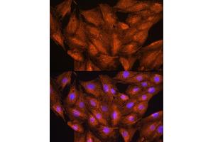 Immunofluorescence analysis of H9C2 cells using D Rabbit pAb (ABIN6127743, ABIN6139383, ABIN6139384 and ABIN6223348) at dilution of 1:100. (DAAM2 Antikörper  (AA 1-86))