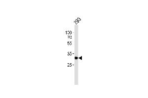 Western Blotting (WB) image for anti-Ribosomal Protein S6 (RPS6) antibody (ABIN6242615)