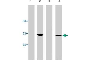 Western blot analysis using VSX2 polyclonal antibody at 1 ug/mL on rat liver (lane 1), retina tissue lysate (lane 2), mouse liver (lane 3) and retina (lane 4) tissue lysate. (VSX2 Antikörper  (AA 1-131))
