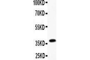 Anti-CD23 Picoband antibody,  All lanes: Anti-CD23 at 0. (FCER2 Antikörper  (AA 50-331))
