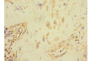 Immunohistochemistry of paraffin-embedded human placenta tissue using ABIN7152671 at dilution of 1:100 (FCRL6 Antikörper  (AA 20-307))