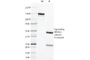 SDS-PAGE Analysis of Purified Chromogranin A Monoclonal Antibody (LK2H10). (Chromogranin A Antikörper)
