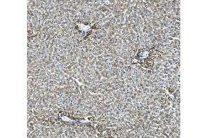 IHC analysis of Glycine decarboxylase/GLDC using anti-Glycine decarboxylase/GLDC antibody (ABIN7602073).