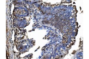 IHC analysis of TRIM25/EFP using anti-TRIM25/EFP antibody (ABIN7599491).