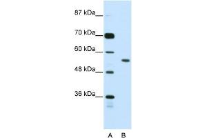 WB Suggested Anti-BRD3 Antibody Titration:  2. (BRD3 Antikörper  (N-Term))