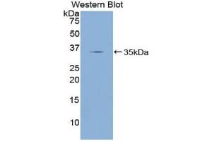 Western blot analysis of the recombinant protein. (KLF4 Antikörper  (AA 187-474))
