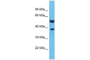 Western Blotting (WB) image for anti-Olfactory Receptor, Family 4, Subfamily L, Member 1 (OR4L1) (C-Term) antibody (ABIN2791742) (OR4L1 Antikörper  (C-Term))