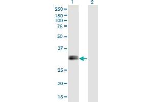 Western Blot analysis of IGFBP1 expression in transfected 293T cell line by IGFBP1 monoclonal antibody (M01), clone 2F9. (IGFBPI Antikörper  (AA 160-259))