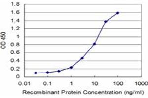 Detection limit for recombinant GST tagged DLX1 is approximately 0.